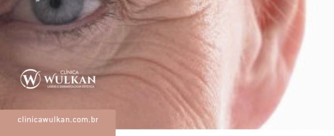 Uma aula sobre nossas rugas e o papel dos preenchimentos