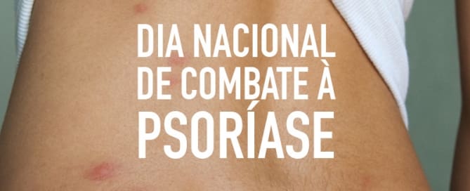 Dia Nacional de Combate à Psoríase