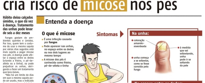 017 VIva MicoseNosPes Micose Nos Pés - Viva