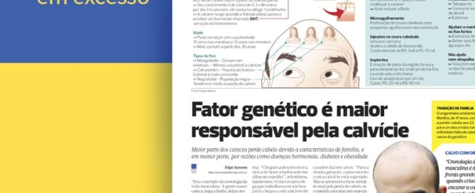 Fator genético é maior responsável pela calvicie