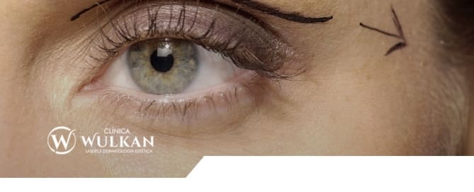Correção da Pálpebra - Blefaroplastia