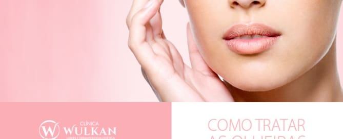 Como tratar as olheiras