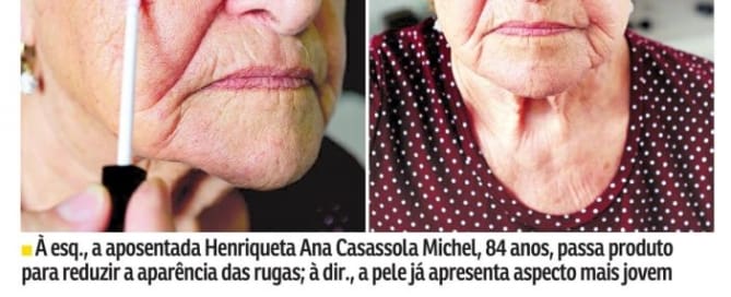 rejuvescimento facial Jornal Agora (Revista da Hora) - Efeito Cinderela
