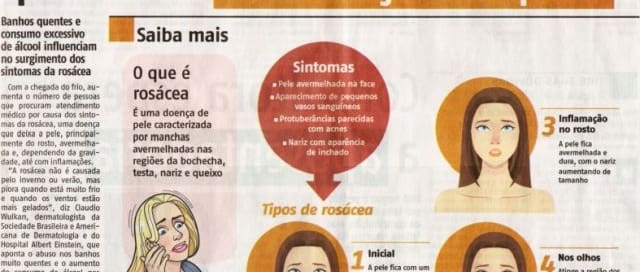 Frio pode intensificar inflamação Jornal Agora - Rosácea