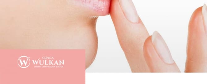 Como tratar o Herpes Labial