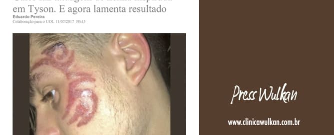 Cuidado ao fazer uma tatuagem!