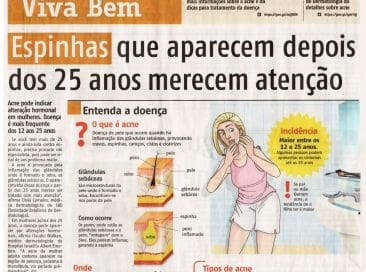 Espinhas depois dos 25 anos Jornal Agora - Acne