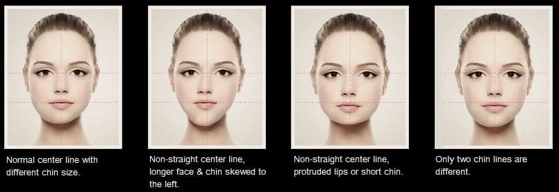 especialista-sp-harmonizacao-facial