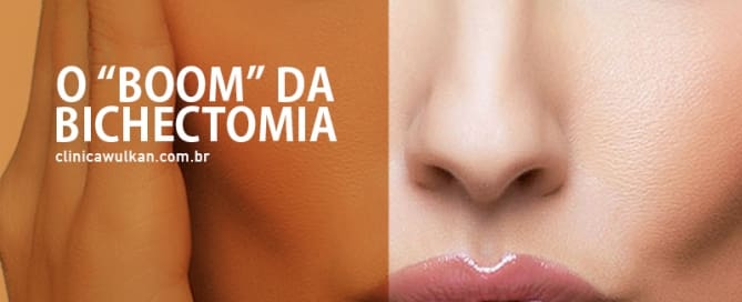 O “boom” da bichectomia...