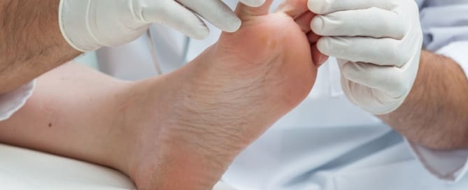 Como evitar micoses da pele?