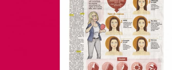 O frio pode intensificar doença que causa inflamação de pele.