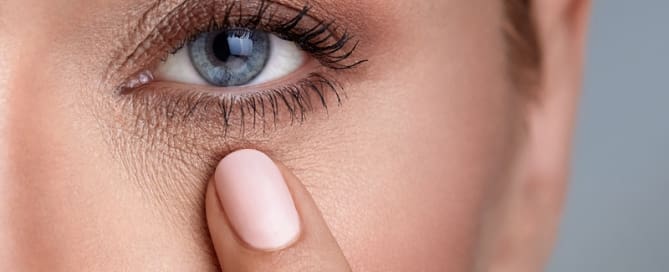 Olheiras têm tratamento!