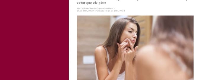 clinicawulkan 26 Não conseguiu conviver com o ponto amarelado no rosto e acabou mexendo nele?