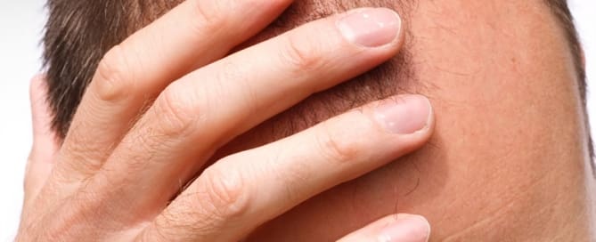 Queda de cabelo? 3 Queda de cabelo?