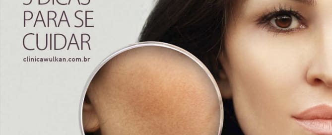 Melasma – 5 Dicas para se cuidar