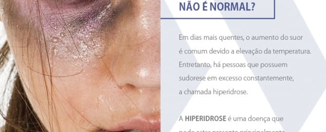 Você sabia que suar em excesso não é normal?