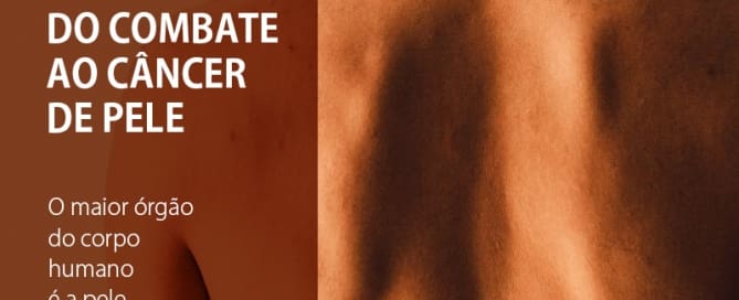 1 de maio. Dia Mundial do Combate ao Câncer de Pele