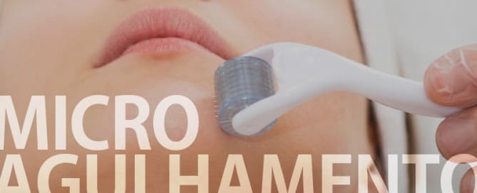 MICROAGULHAMENTO - DERMAROLLER OU IPCA