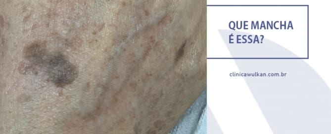 Que mancha é essa?