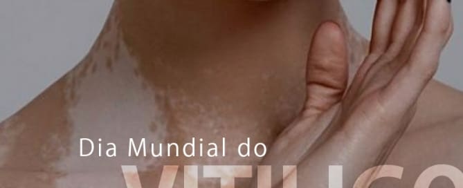 Dia Mundial do Vitiligo