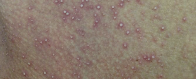 Não se automedique!