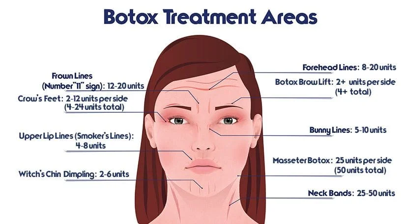 aplicacao de botox em sao paulo