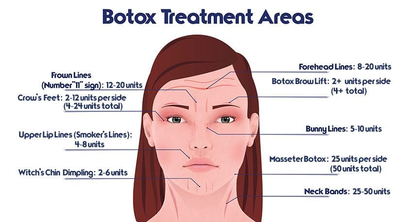 tratamento Osasco aplicação botox