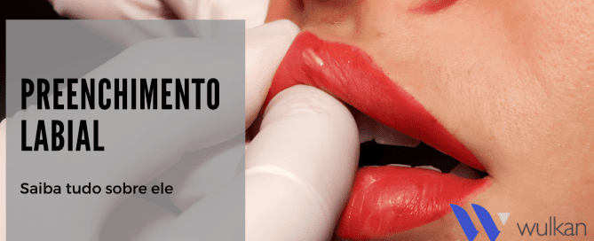 13 05 21 – WULKAN Preenchimento Labial capa Preenchimento Labial