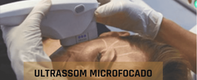 aplicacao de ultraformer