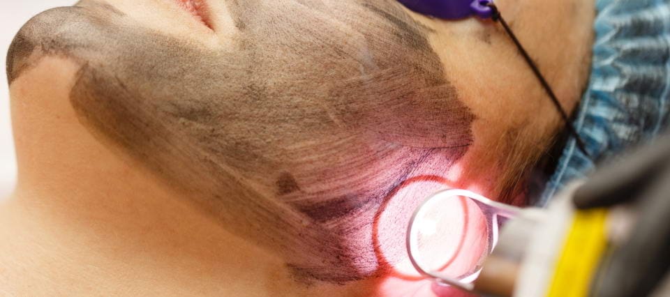 laser dermatologia sao paulo tratamento