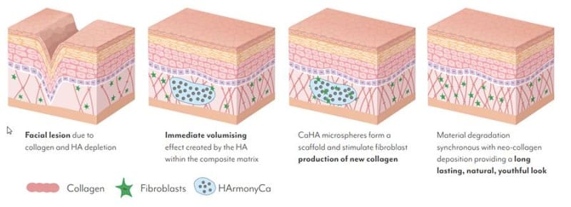 como funciona o HarmonyCA