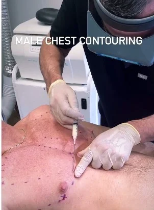 Aumento do peitoral sem cirurgia