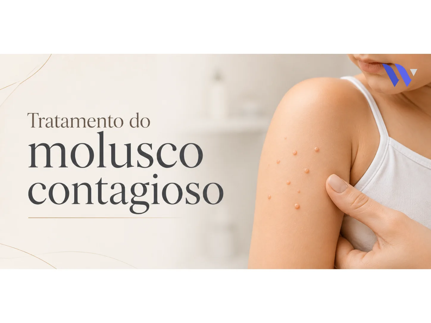 Tratamento do Molusco Contagioso Tratamento do Molusco Contagioso