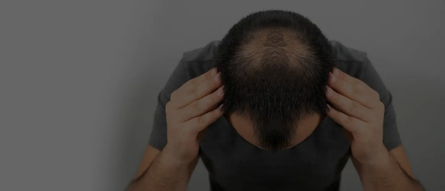 Como Tirar Chiclete do Cabelo e da Sobrancelha Sem Cortar