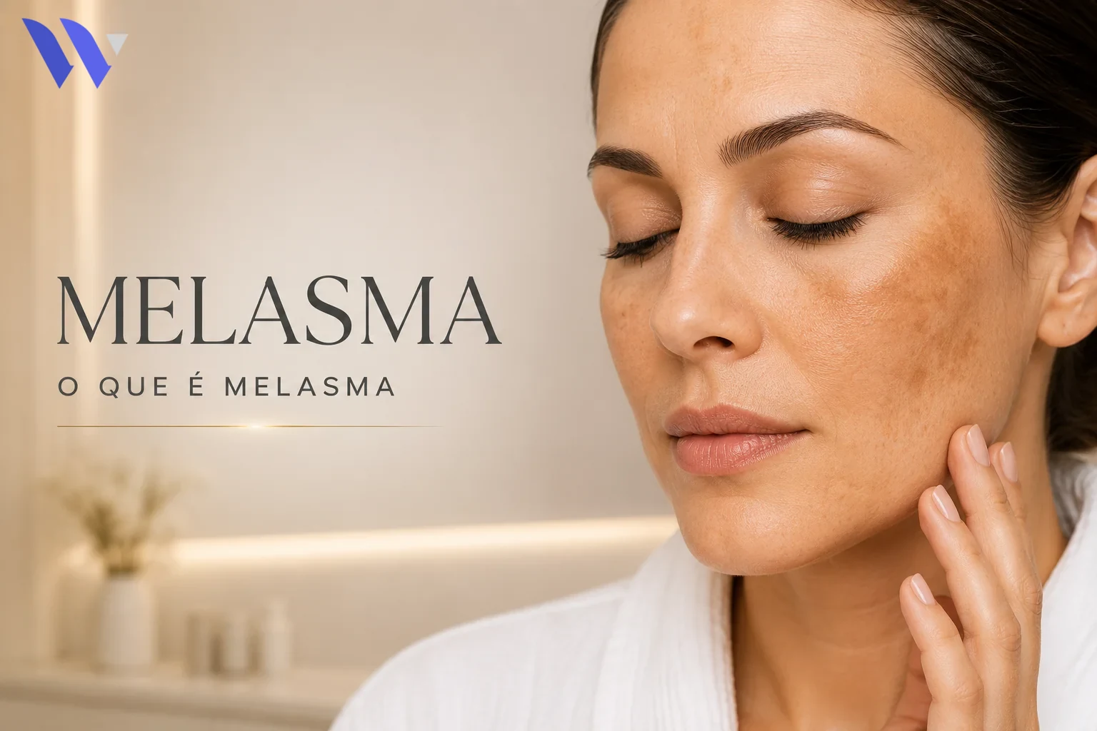 Melasma – O Que é Melasma