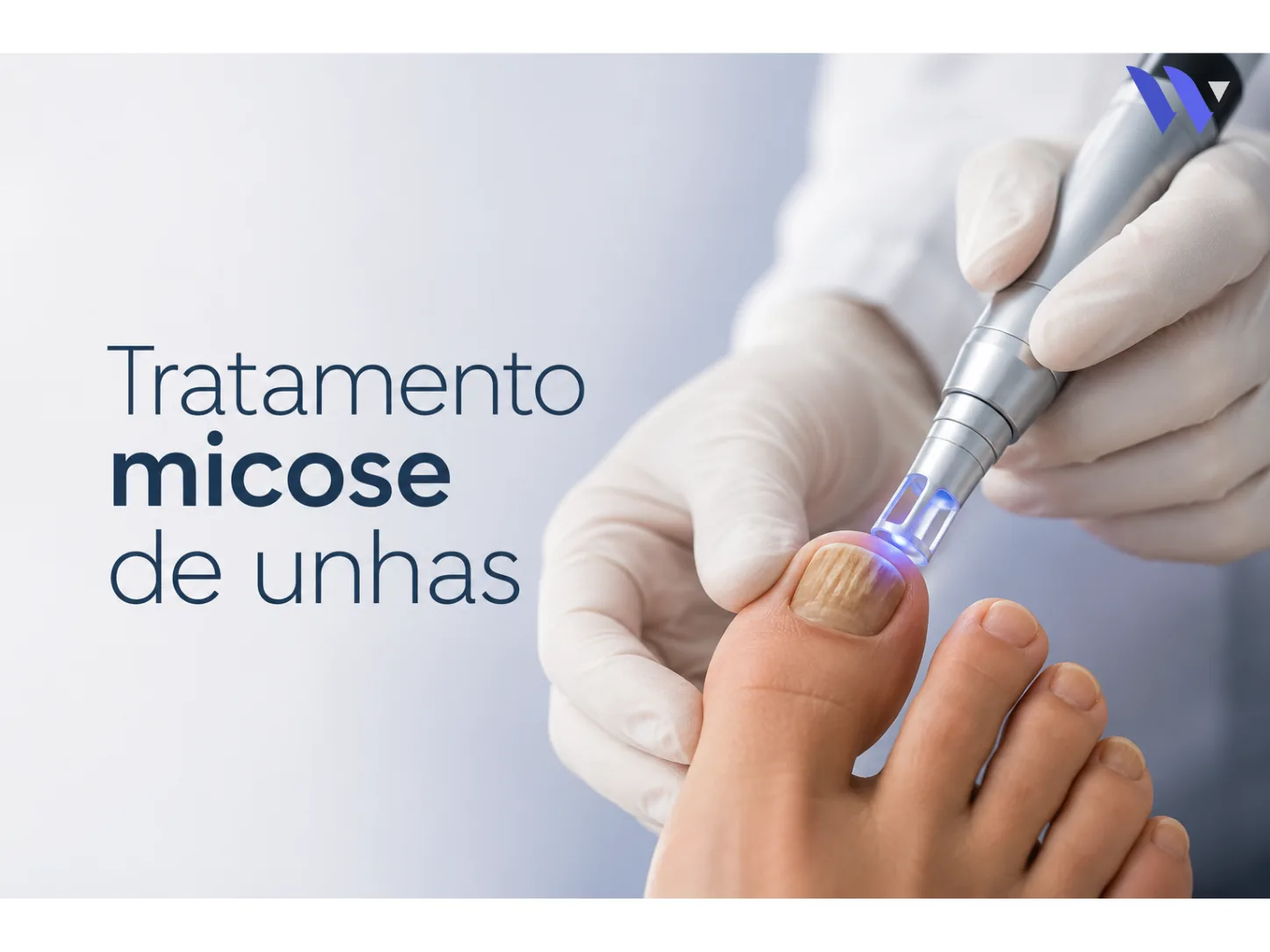 Micose das unhas: tratamento longo