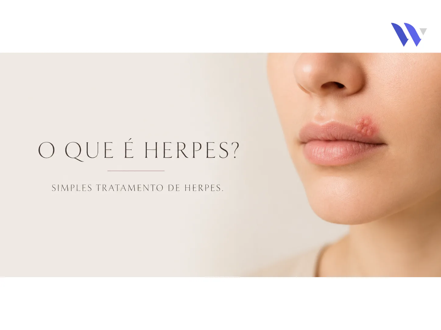 Herpes